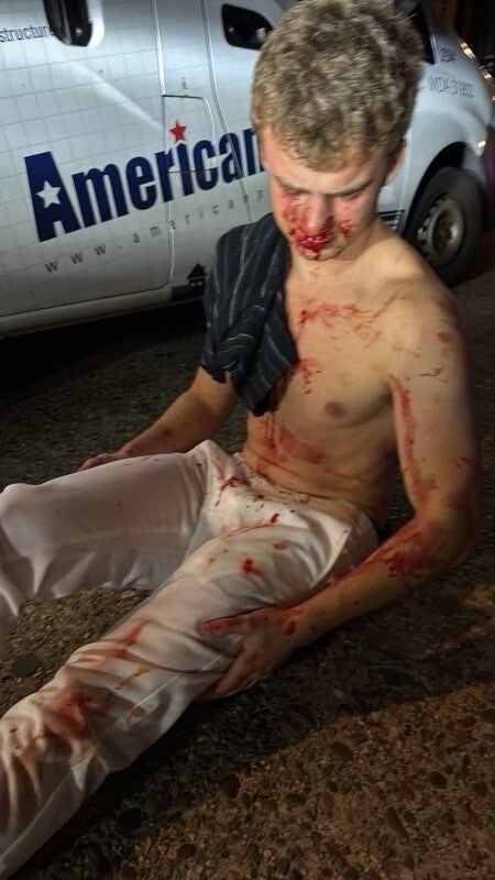 President Donald Trump shared a photo of the bloodied former DOGE worker on Truth Social Tuesday and said crime was ‘out of control’ in D.C. but did not name him.