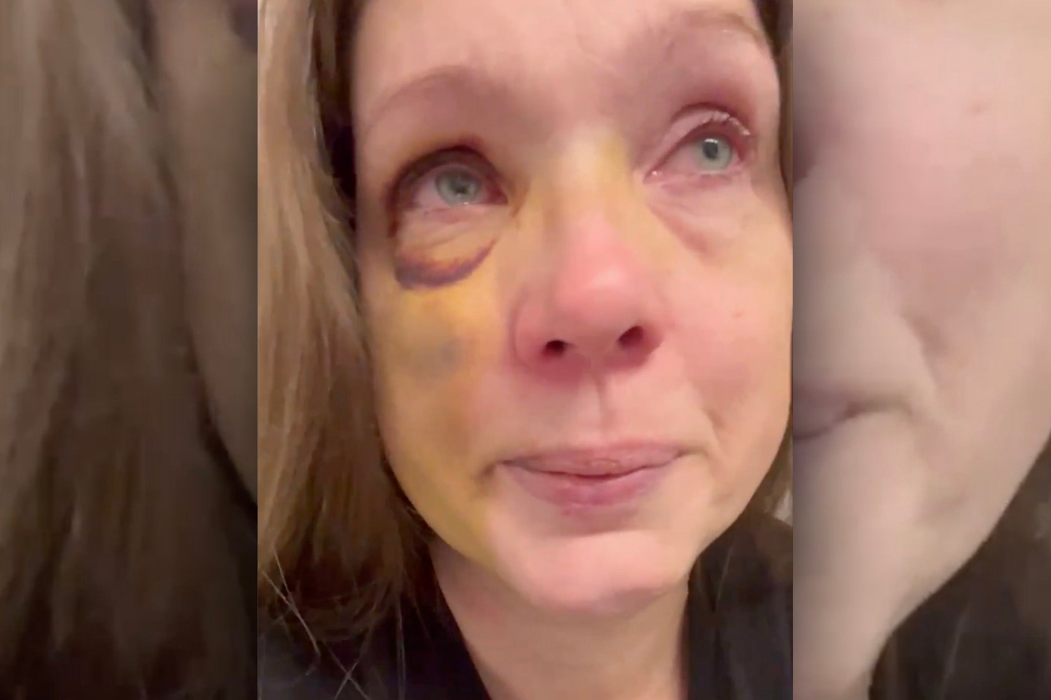Holly was one of the people attacked by a mob in downtown Cincinnati on July 26, 2025