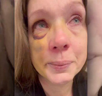 Mom knocked out in Cincinnati mob attack breaks silence after suffering ‘brain trauma’