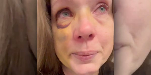 Mom knocked out in Cincinnati mob attack breaks silence after suffering ‘brain trauma’