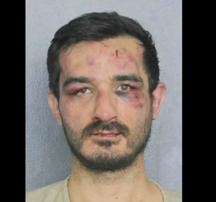 Mugshot shows burglary suspect beaten black and blue after targeting MMA fighter’s Florida home