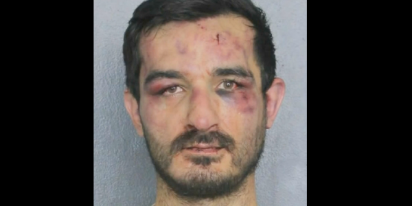 Mugshot shows burglary suspect beaten black and blue after targeting MMA fighter’s Florida home