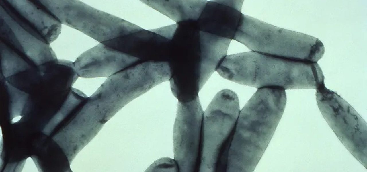 Two cases of Legionnaires’ disease reported in Bloomingdale rehab center: officials