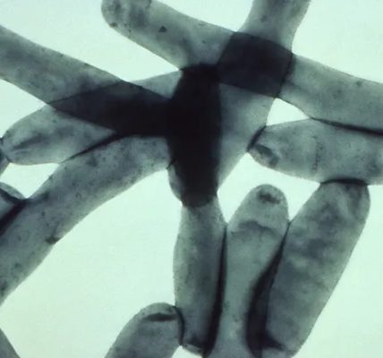 Two cases of Legionnaires’ disease reported in Bloomingdale rehab center: officials